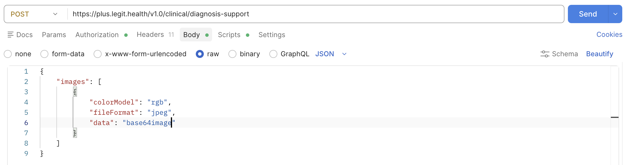 Screen capture of Postman